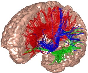 Drawing of human brain cross-section with red, green & blue lines of nerves 